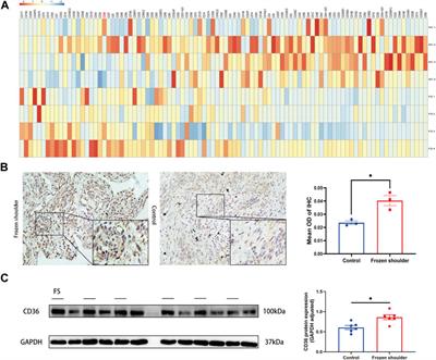 Salvianolic acid B attenuates inflammation and prevent pathologic fibrosis by inhibiting CD36-mediated activation of the PI3K-Akt signaling pathway in frozen shoulder